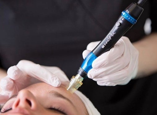 Microneedling Package (6 sessions)